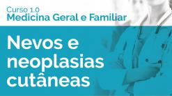 Nevos e neoplasias cutâneas 